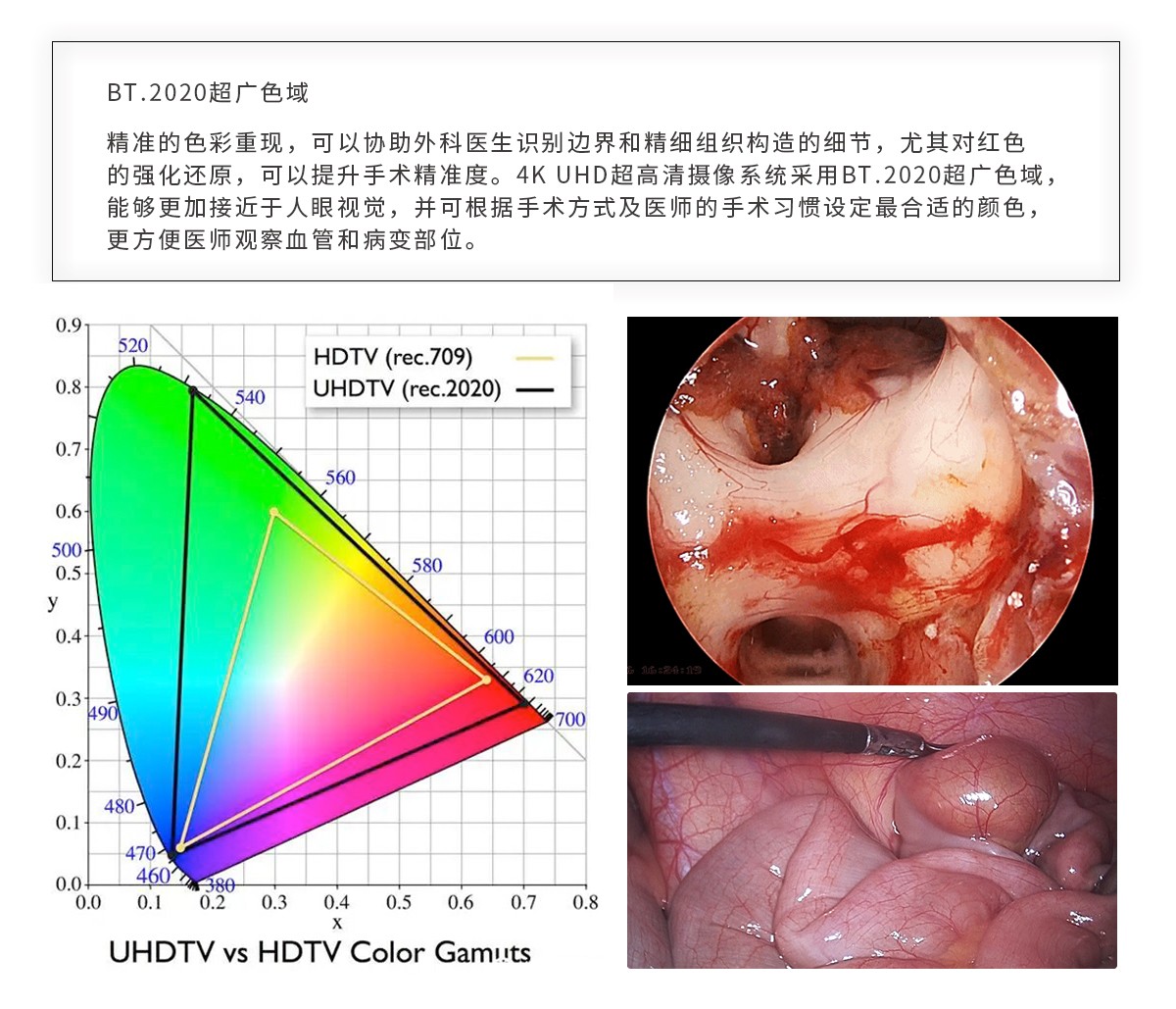 【4K醫(yī)用內(nèi)窺鏡攝像系統(tǒng)】您的第一臺“4K”找到了嗎？