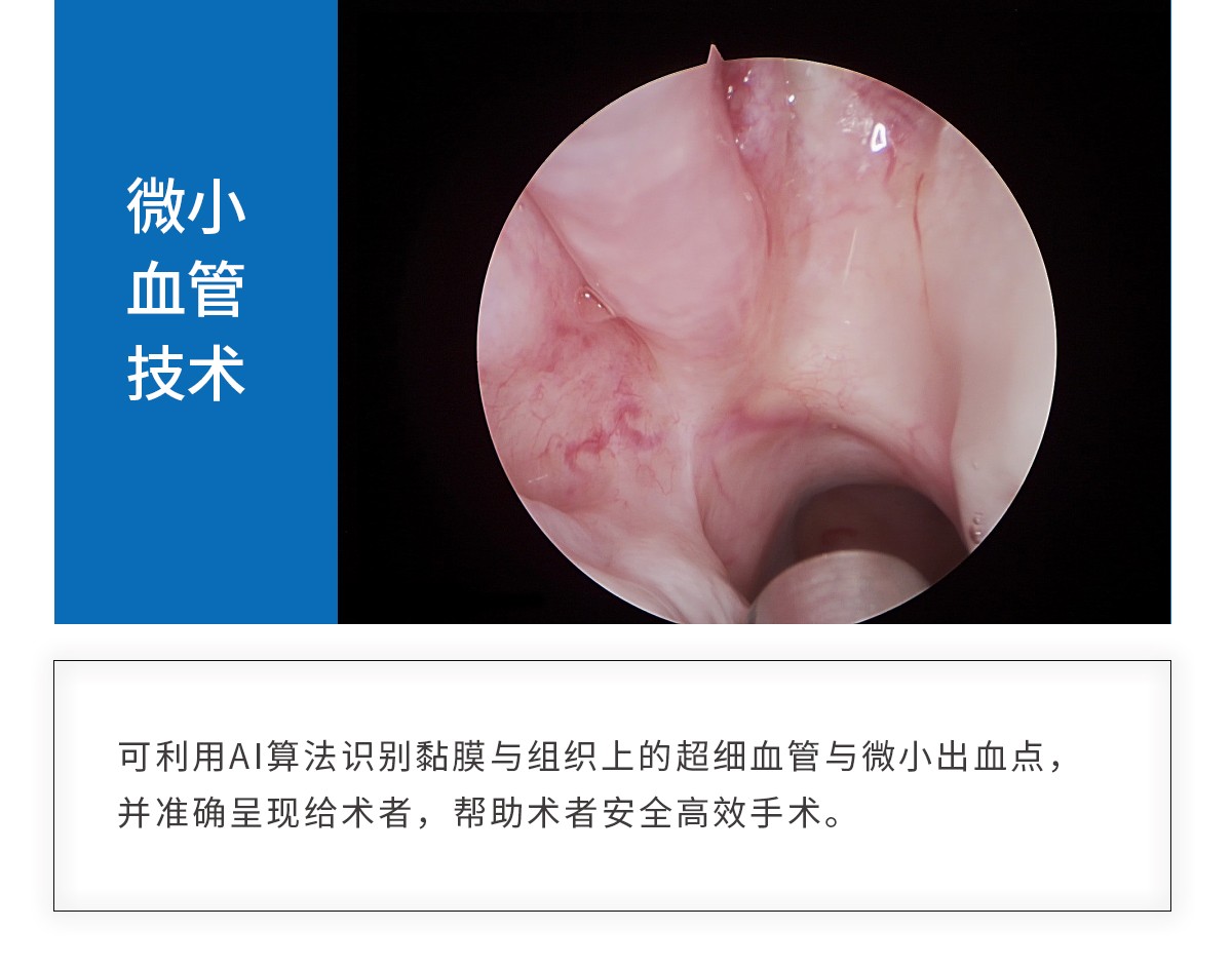 【4K醫(yī)用內(nèi)窺鏡攝像系統(tǒng)】您的第一臺“4K”找到了嗎？