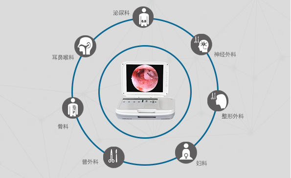 內(nèi)窺鏡攝像機的應(yīng)用領(lǐng)域有哪些？